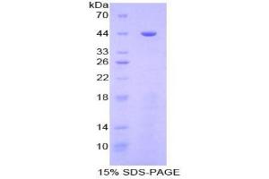 SDS-PAGE analysis of Human Golgi Protein 73 Protein. (GOLM1 Protéine)