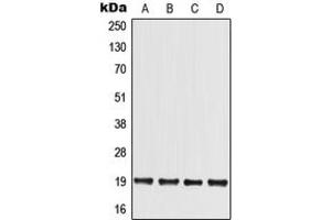 Western blot analysis of MED30 expression in HCT116 (A), HEK293T (B), Raw264. (MED30 anticorps  (Center))