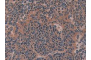 Detection of OLFM4 in Mouse Spleen Tissue using Polyclonal Antibody to Olfactomedin 4 (OLFM4)