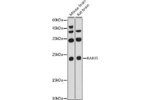 Western blot analysis of extracts of various cell lines, using R antibody (ABIN6133143, ABIN6146576, ABIN6146578 and ABIN6224057) at 1:1000 dilution. (RAB35 anticorps  (AA 1-201))