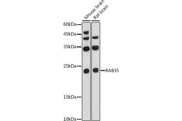 RAB35 anticorps  (AA 1-201)