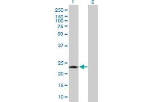 Western Blot analysis of PCTP expression in transfected 293T cell line by PCTP MaxPab polyclonal antibody. (PCTP anticorps  (AA 1-214))