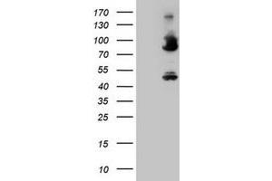 Image no. 3 for anti-Coagulation Factor XIII, A1 Polypeptide (F13A1) antibody (ABIN1498152) (F13A1 anticorps)