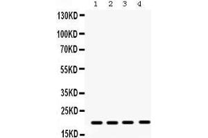 Western Blotting (WB) image for anti-Non-Metastatic Cells 1, Protein (NM23A) Expressed in (NME1) (AA 26-58), (N-Term) antibody (ABIN3043572) (NME1 anticorps  (N-Term))