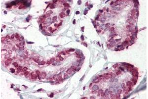 Human Breast (formalin-fixed, paraffin-embedded) stained with CD44 antibody ABIN364348 at 5 ug/ml followed by biotinylated anti-mouse IgG secondary antibody ABIN481714, alkaline phosphatase-streptavidin and chromogen.