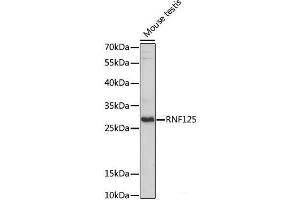 Western blot analysis of extracts of Mouse testis using RNF125 Polyclonal Antibody at dilution of 1:1000. (RNF125 anticorps)