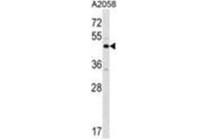 XKR3 Antibody (C-term) western blot analysis in A2058 cell line lysates (35 µg/lane). (XKR3 anticorps  (C-Term))