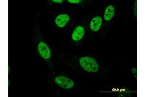 Immunofluorescence of monoclonal antibody to PASD1 on HeLa cell. (PASD1 anticorps  (AA 1-100))
