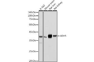 Western blot analysis of extracts of various cell lines, using /GSNOR antibody (ABIN6131172, ABIN6136579, ABIN6136580 and ABIN6217464) at 1:500 dilution. (ADH5 anticorps  (AA 1-374))