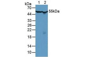 Figure. (CCT2 anticorps  (AA 1-488))