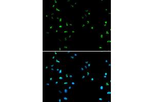 Immunofluorescence analysis of A549 cell using HDAC4 antibody. (HDAC4 anticorps  (AA 530-630))