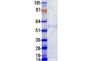 Validation with Western Blot