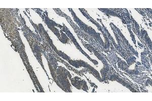 IHC analysis of MAPK11 using anti-MAPK11 antibody (ABIN7600772).