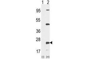 Western blot analysis of PTP4A2 (arrow) using rabbit polyclonal PTP4A2 Antibody (Center) . (PTP4A2 anticorps  (Middle Region))