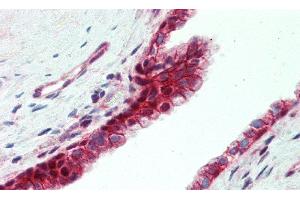 Detection of UTRN in Human Prostate Tissue using Polyclonal Antibody to Utrophin (UTRN)