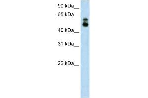WB Suggested Anti-HDAC9 Antibody Titration:  1. (HDAC9 anticorps  (C-Term))