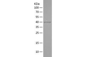 Western Blotting (WB) image for Glucagon (GCG) (AA 21-180) protein (His-IF2DI Tag) (ABIN7123098)