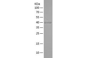 Western Blotting (WB) image for Glucagon (GCG) (AA 21-180) protein (His-IF2DI Tag) (ABIN7123098) (Glucagon Protein (GCG) (AA 21-180) (His-IF2DI Tag))