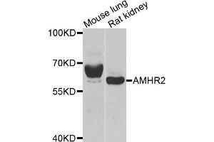 Western blot analysis of extracts of various cell lines, using AMHR2 antibody. (AMHR2 anticorps)