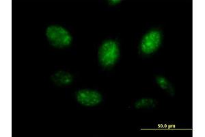 Immunofluorescence of purified MaxPab antibody to MYB on HeLa cell. (MYB anticorps  (AA 1-640))