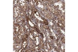 Immunohistochemical staining of human kidney with KIAA1524 polyclonal antibody  shows strong cytoplasmic positivity in renal tubules at 1:200-1:500 dilution. (KIAA1524 anticorps)