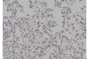ABIN6278744 at 1/100 staining Rat lung tissue by IHC-P. (TTF1 anticorps  (Internal Region))