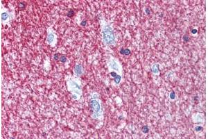 Human Brain, cortex: Formalin-Fixed, Paraffin-Embedded (FFPE) (Cnpase anticorps  (AA 122-352))