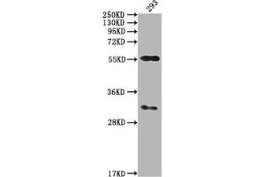 Western Blot Positive WB detected in: 293 whole cell lysate All lanes: CAMK2A antibody at 1:2000 Secondary Goat polyclonal to rabbit IgG at 1/50000 dilution Predicted band size: 55, 56 kDa Observed band size: 55 kDa (CAMK2A anticorps  (AA 321-478))