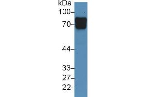 Detection of VASN in Human Urine using Polyclonal Antibody to Vasorin (VASN)
