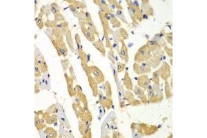 Immunohistochemistry of paraffin-embedded mouse heart using HNMT antibody (ABIN6292124) at dilution of 1:100 (40x lens). (HNMT anticorps)