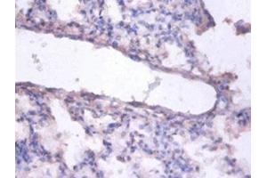 Immunohistochemistry of paraffin-embedded human lung tissue using ABIN7151790 at dilution of 1:100 (ERH anticorps  (AA 2-104))