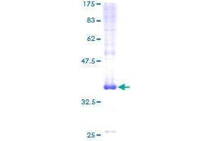 Image no. 1 for Chromosome 20 Open Reading Frame 30 (C20orf30) (AA 1-120) protein (GST tag) (ABIN1347428) (C20orf30 Protein (AA 1-120) (GST tag))