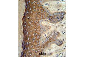 KRT1 Antibody (Center) IHC analysis in formalin fixed and paraffin embedded skin tissue followed by peroxidase conjugation of the secondary antibody and DAB staining.