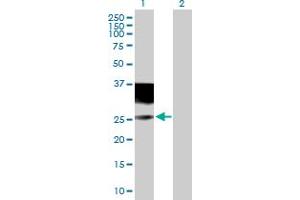 Western Blot analysis of IL4R expression in transfected 293T cell line by IL4R MaxPab polyclonal antibody. (IL4 Receptor anticorps  (AA 1-227))