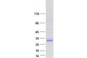 Validation with Western Blot