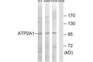 Western blot analysis of extracts from NIH/3T3 cells, A549 cells and HT-29 cells, using ATP2A1 antibody.