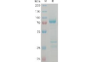 Human Protein, hFc Tag on SDS-PAGE under reducing condition.