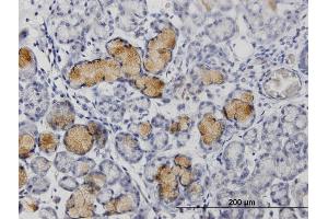 Immunoperoxidase of purified MaxPab rabbit antibody to MMP1 on formalin-fixed paraffin-embedded human colon. (MMP1 anticorps  (AA 1-469))