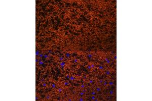 Immunofluorescence analysis of rat brain using SN Rabbit pAb (ABIN3021231, ABIN3021232, ABIN3021233 and ABIN6214078) at dilution of 1:100 (40x lens). (SNAP25 anticorps  (AA 1-206))