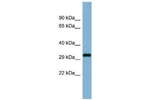 C20ORF116 antibody used at 1 ug/ml to detect target protein. (DDRGK1 anticorps  (N-Term))