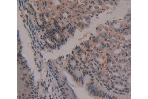 Used in DAB staining on fromalin fixed paraffin- embedded Kidney tissue