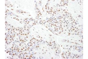 anti-Cyclin-Dependent Kinase 9 (CDK9) (AA 322-372) antibody