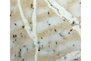 Used in DAB staining on fromalin fixed paraffin-embedded muscle tissue