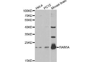 Western blot analysis of extracts of various cell lines, using RAB5A antibody. (RAB5 anticorps)