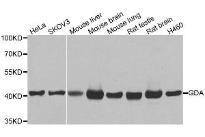Western blot analysis of extracts of various cell lines, using GDA antibody.