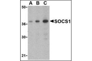 Western blot analysis of SOCS1 in Human spleen cell lysate with this product at (A) 1, (B) 2 and (C) 4 μg/ml. (SOCS1 anticorps  (C-Term))