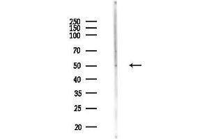 Western blot analysis of lysates from MCF7 cells(heat-shock,45 min treatment), using ARHGAP1 Antibody at 1/1000 dilution.