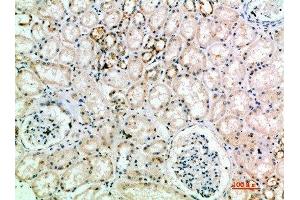 Immunohistochemical analysis of paraffin-embedded human-kidney, antibody was diluted at 1:200