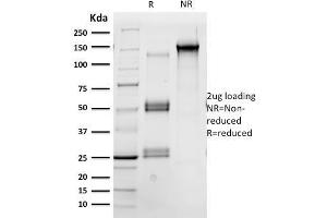 SDS-PAGE Analysis Purified Oct-2 Mouse Monoclonal Antibody (OCT2/2137).