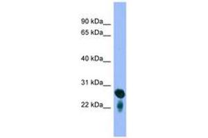 Image no. 1 for anti-RAB5C, Member RAS Oncogene Family (Rab5c) (C-Term) antibody (ABIN6745664) (Rab5c anticorps  (C-Term))